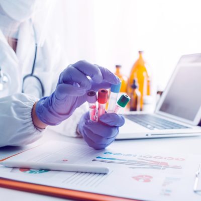 Blood Test