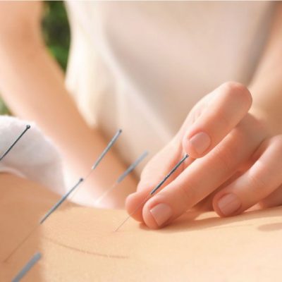 Traditional Chinese medicine